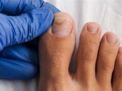 Urgent 24: A magical home trick that will help you get rid of foot fungus within days