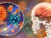 Urgent 24: Meningitis…a silent danger threatening the brain and spinal cord