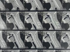 Urgent 24: Microsurgery saves a patient from paralysis at Benha University Hospitals