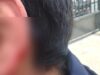 Urgent 24: A bite on his cheek… A guardian of a middle school student in Alexandria calls for help after part of her son’s ear was cut off